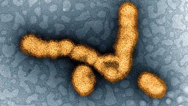 Image: National Institute of Allergy and Infectious Diseases